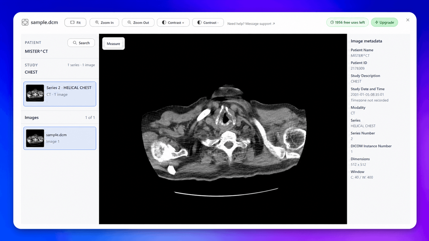 DICOM Viewer showing patient, study, series, instance, and metadata navigation
