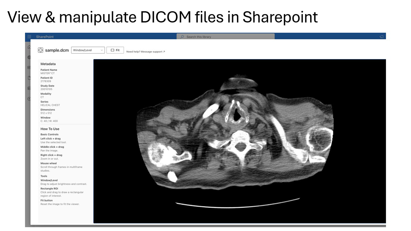 DICOM Viewer for SharePoint displaying a medical image in the browser
